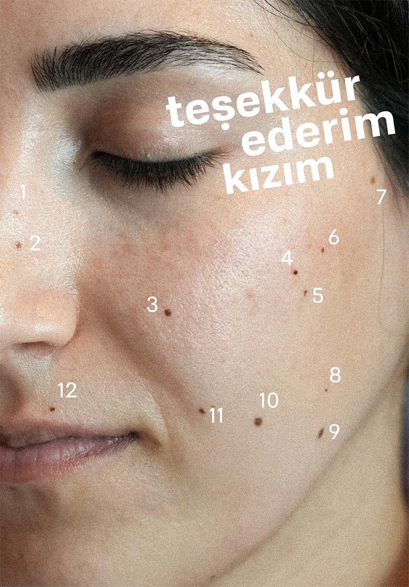 Teşekkür Ederim Kızım 2